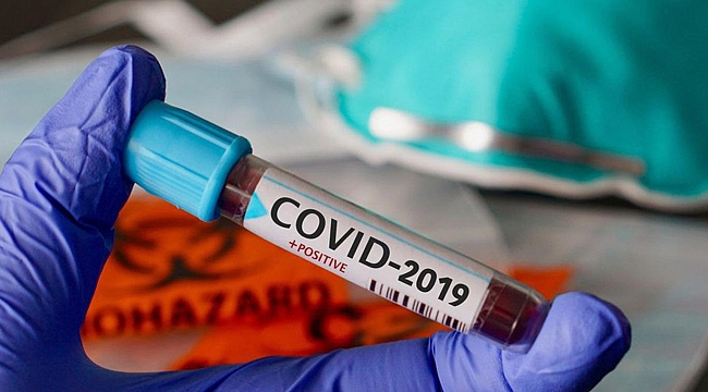 Türkiye'de Coronavirus nedeniyle can kaybı 812'ye yükseldi 